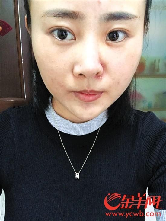 受害人被打前后對比 (圖片由當(dāng)事人提供)